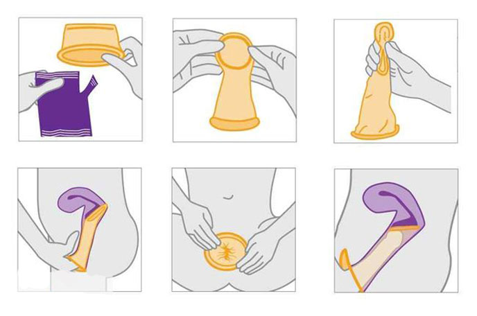 Cách sử dụng bao cao su cho nữ