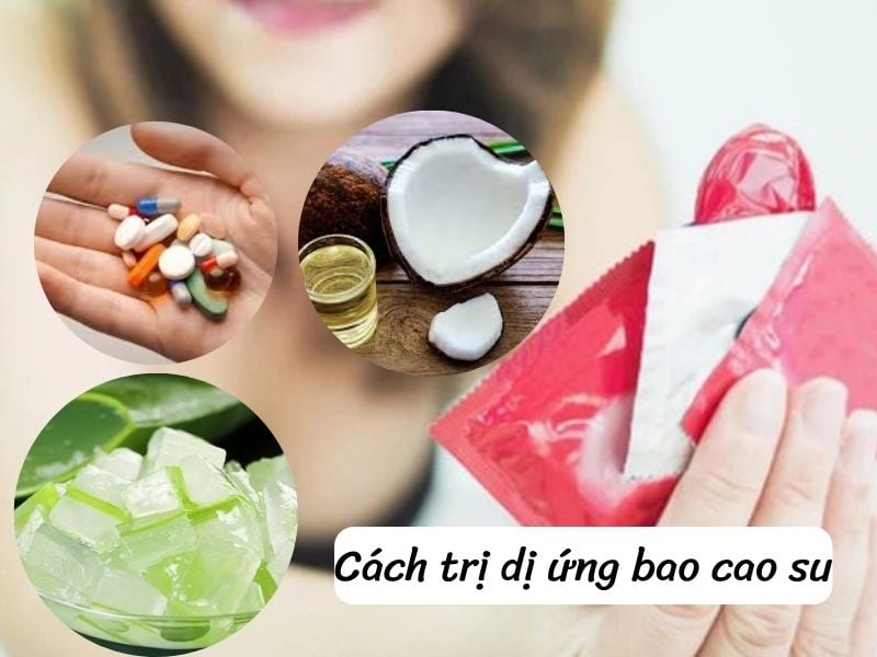 Cách trị dị ứng bao cao su