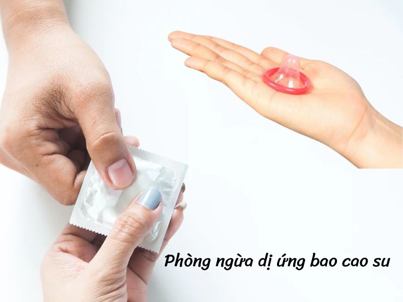 Phòng ngừa dị ứng bao cao su