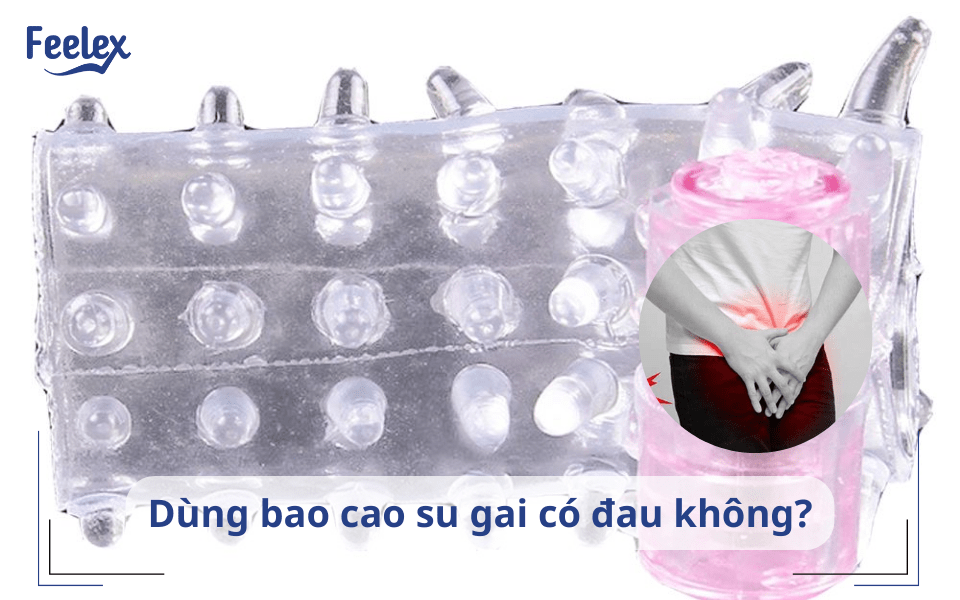 bao cao su co gai co dau khong 1