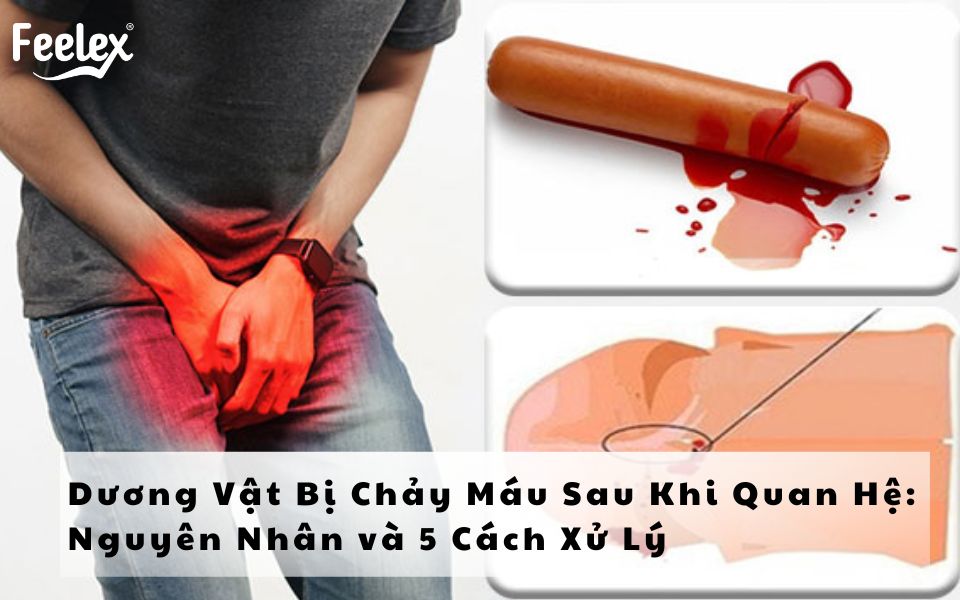 Dương Vật Bị Chảy Máu Sau Khi Quan Hệ Nguyên Nhân và 5 Cách Xử Lý