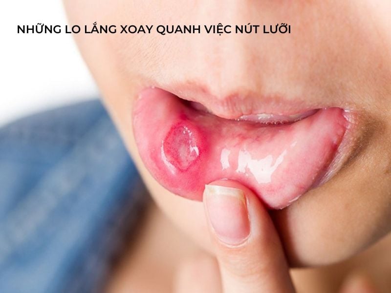 Nhung Lo Lang Xoay Quanh Viec Nut Luoi