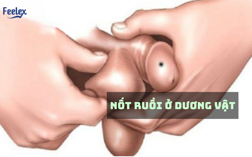 nốt ruồi ở dương vật