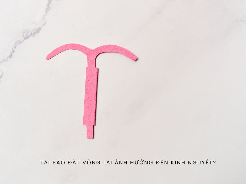 Đặt vòng bị trễ kinh: Cảnh báo bất ngờ hay chỉ là phản ứng bình thường? Nên làm gì khi đặt vòng bị trễ kinh