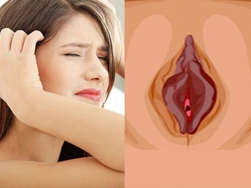 TOP 5 Lý Do Tại Sao Vùng Kín Bị Thâm Khi Chưa Quan Hệ? Tại sao vùng kín bị thâm khi chưa quan hệ?