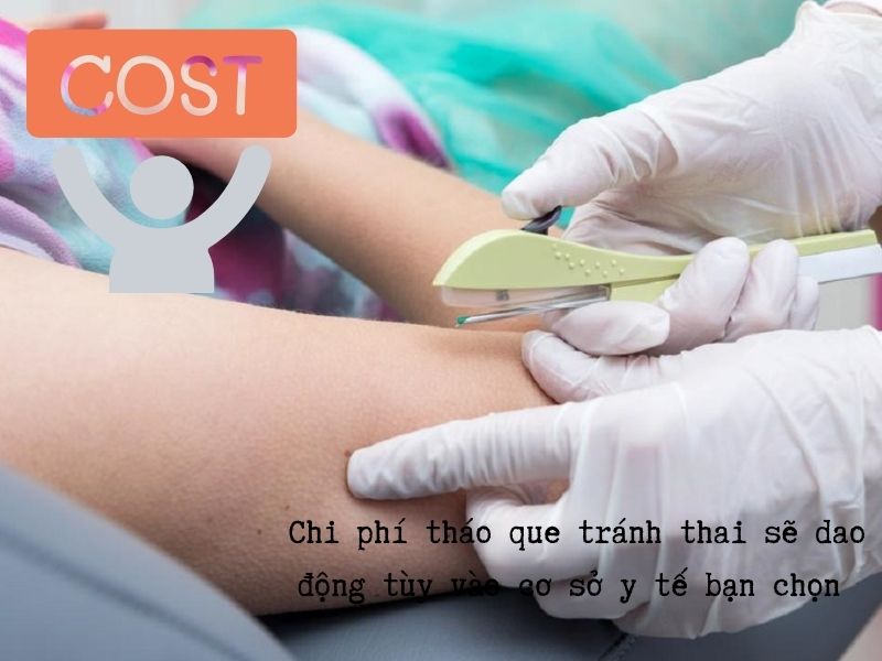Tháo que tránh thai: TOP 5 điều hữu ích bạn cần biết ngay! Tháo que tránh thai hết bao nhiêu tiền?
