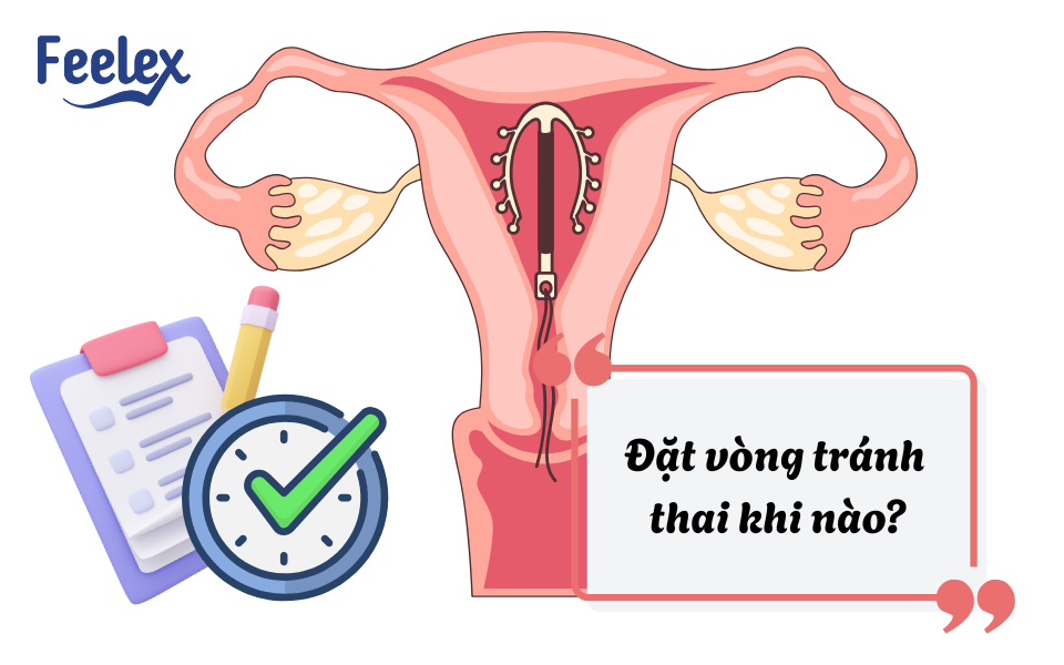 Đặt vòng tránh thai khi nào