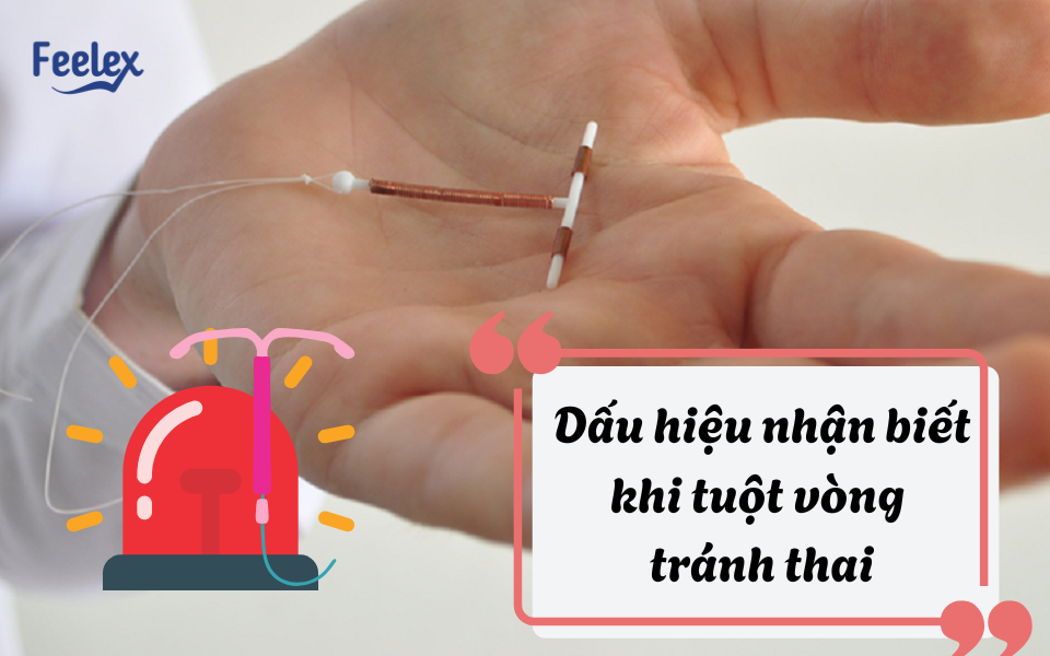 Dấu hiệu nhận biết khi tuột vòng tránh thai