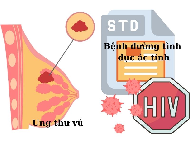 Những ai không nên đặt vòng tránh thai: 5 đối tượng “hàng đầu”! Phụ nữ bị ung thư vú, không nên đặt vòng tránh thai.