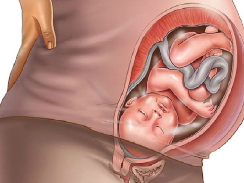 Quan Hệ Nhiều Có Bị Rộng Không? Sự Thật Bất Ngờ Sinh nở làm giãn rộng âm đạo tạm thời, cần thời gian để phục hồi.