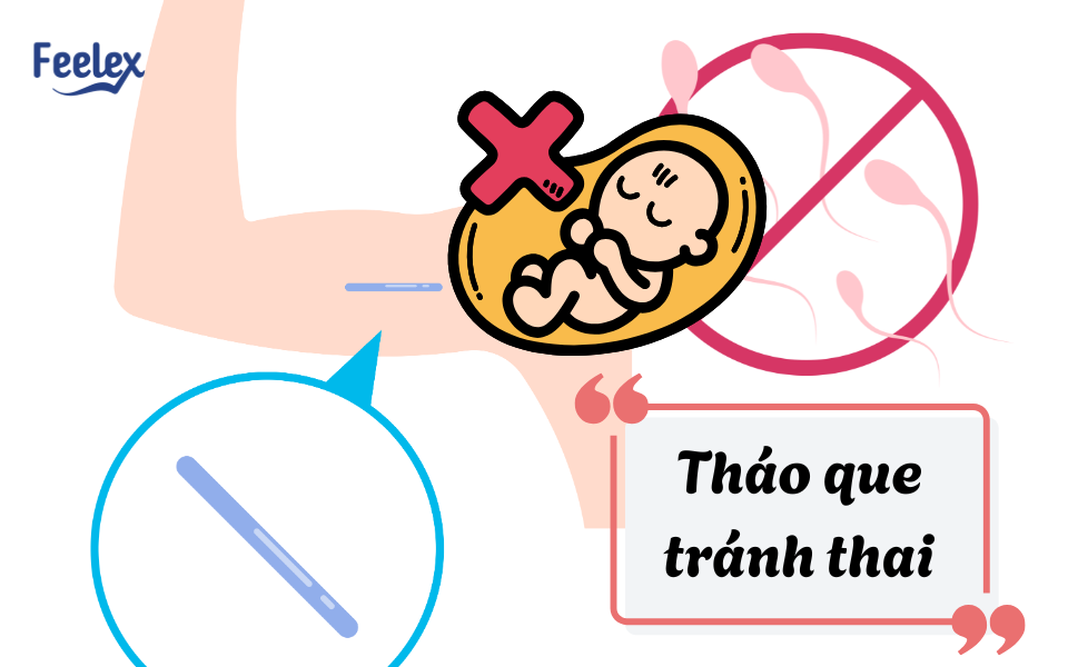 Tháo que tránh thai