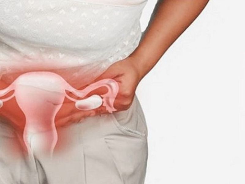 Sau khi đặt thuốc phụ khoa bao lâu thì quan hệ được? Bác sĩ nói gì Trường hợp viêm nhẹ không cần kiêng quan hệ quá lâu