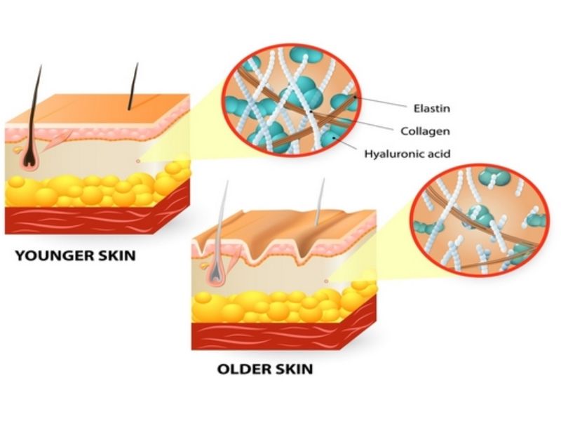 Quan Hệ Nhiều Có Bị Rộng Không? Sự Thật Bất Ngờ Tuổi tác khiến mô âm đạo mất dần độ đàn hồi do giảm collagen và elastin.