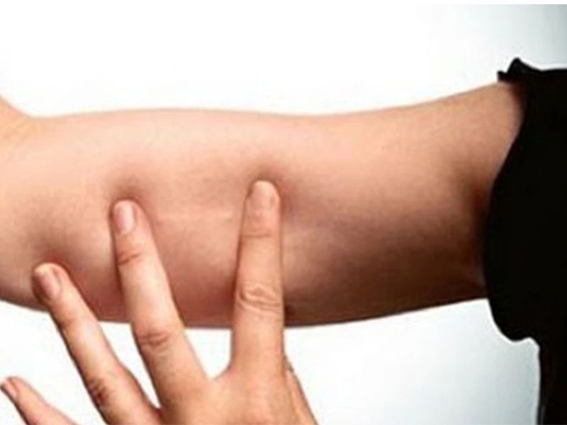 Cảnh báo: 4 sai lầm thường gặp khi hỏi có nên cấy que tránh thai có nên cấy que tránh thai không