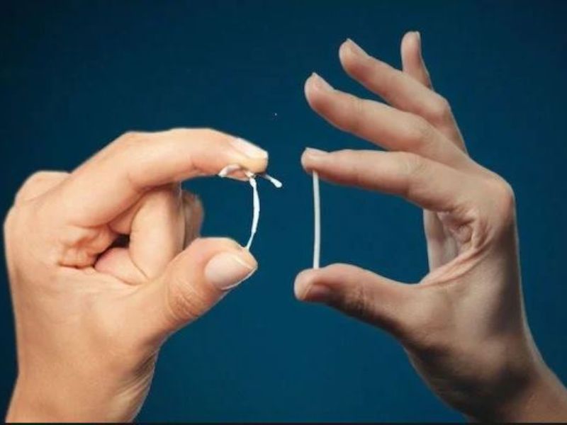Cảnh báo: 4 sai lầm thường gặp khi hỏi có nên cấy que tránh thai Co nen cay que tranh thai khi quan he khong dung bao