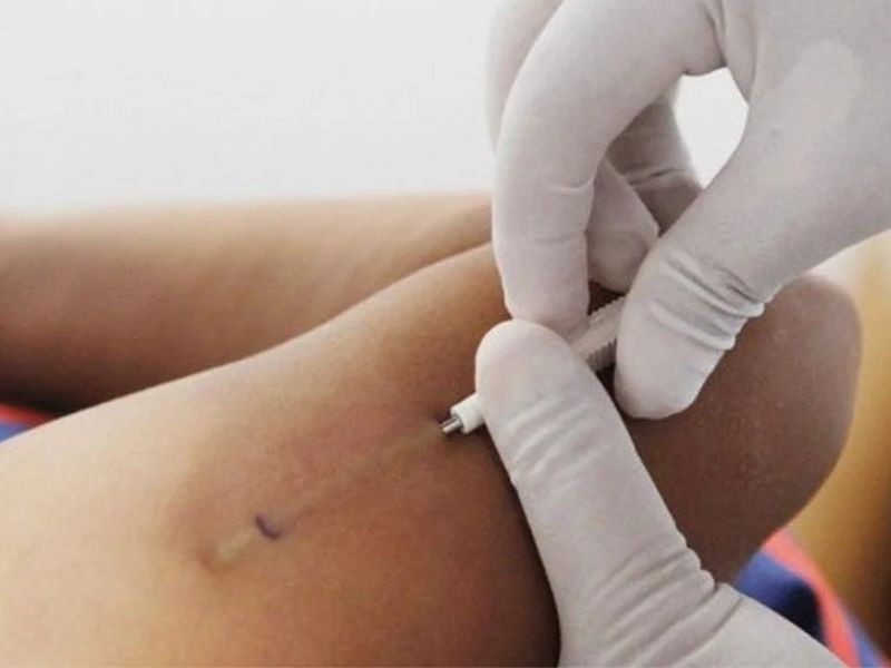 Cảnh báo: 4 sai lầm thường gặp khi hỏi có nên cấy que tránh thai Có nên cấy que tránh thai