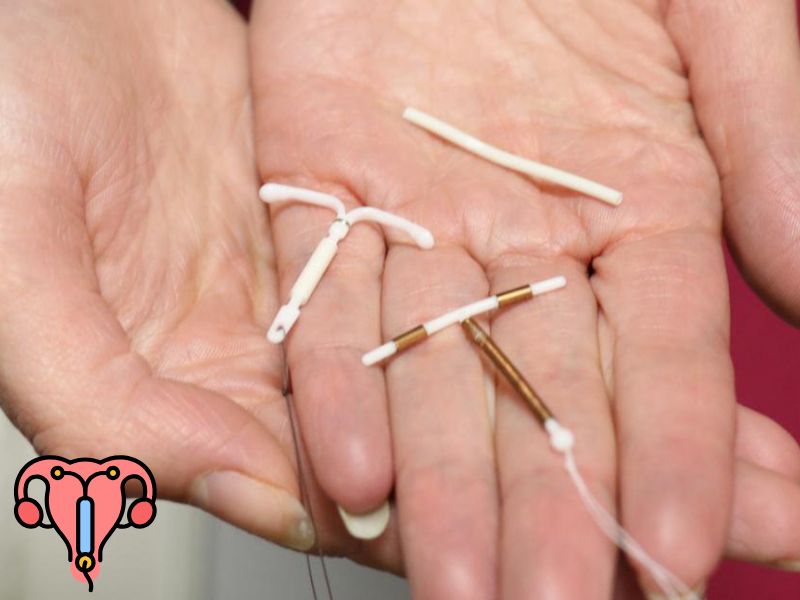 Cách tránh thai sau khi quan hệ 1 tuần: Có còn hiệu quả không? Dung vong tranh thai khan cap (IUD) – neu chua qua 5 ngay