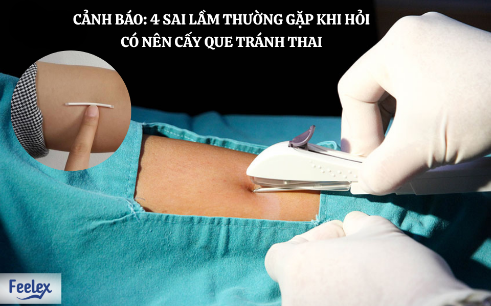 có nên cấy que tránh thai