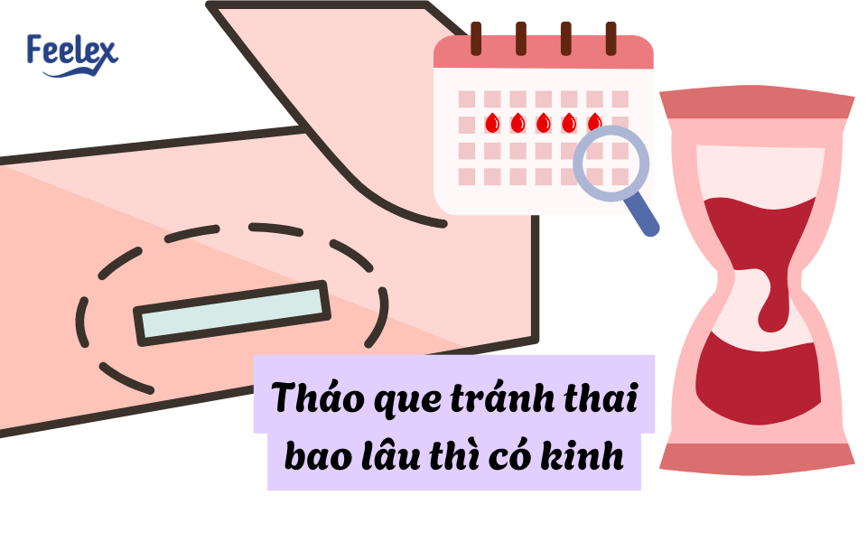 Tháo que tránh thai bao lâu thì có kinh