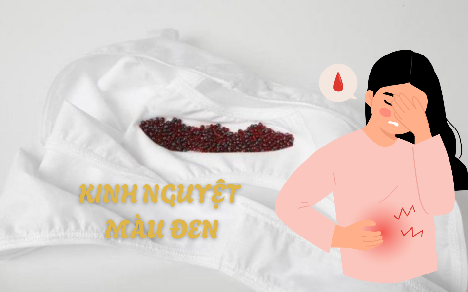 Kinh nguyệt màu đen